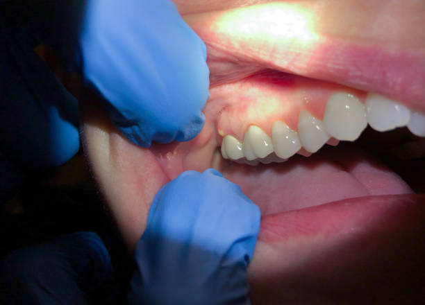 Best Weekend Emergency Dentist in Marietta, GA