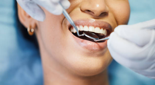 Best Emergency Dental Care for Abscessed Tooth in Marietta, GA